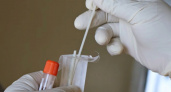 В Пензенской области за прошедшую неделю от коронавируса скончался 1 человек