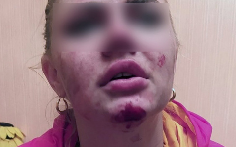 В Пензе девушку внезапно атаковал таксист