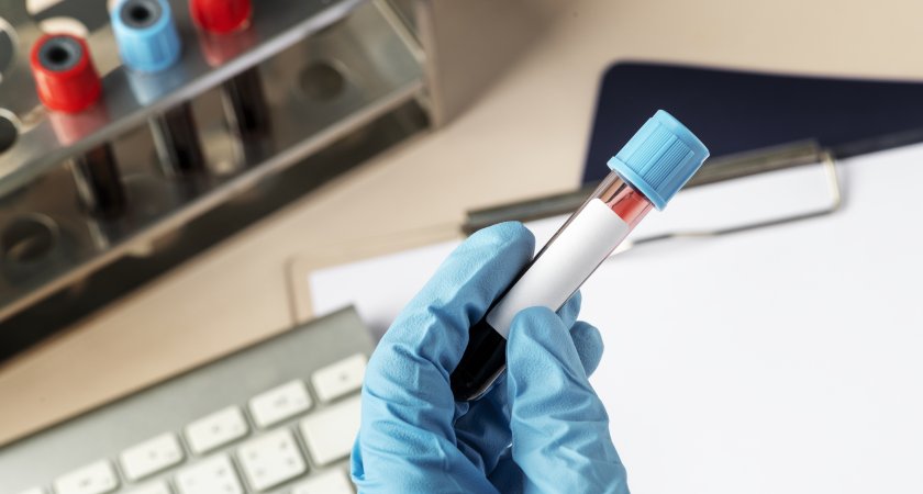 Люди с какой группой крови живут дольше остальных