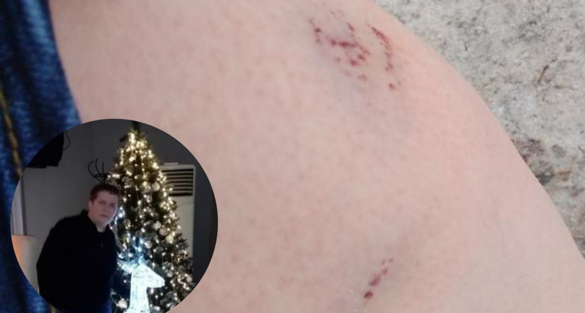 Отбивалась ногами: на пензячку набросилась стая собак