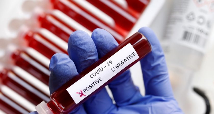 За сутки 43 пензенца заболели коронавирусом