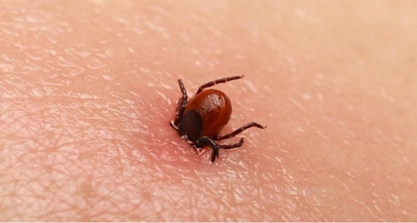 В Пензенской области клещи покусали более 330 детей