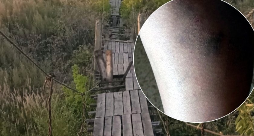 "Дочь разорвала ногу": полуразрушенный мост в Пензенской области калечит людей