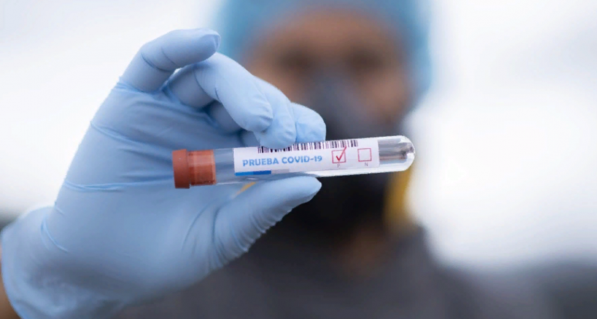 В Пензенской области выявили еще 83 случая коронавируса, один пациент скончался 