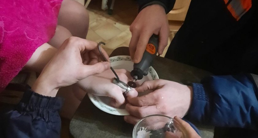 В Пензе спасатели помогли снять кольцо с пальца ребенка