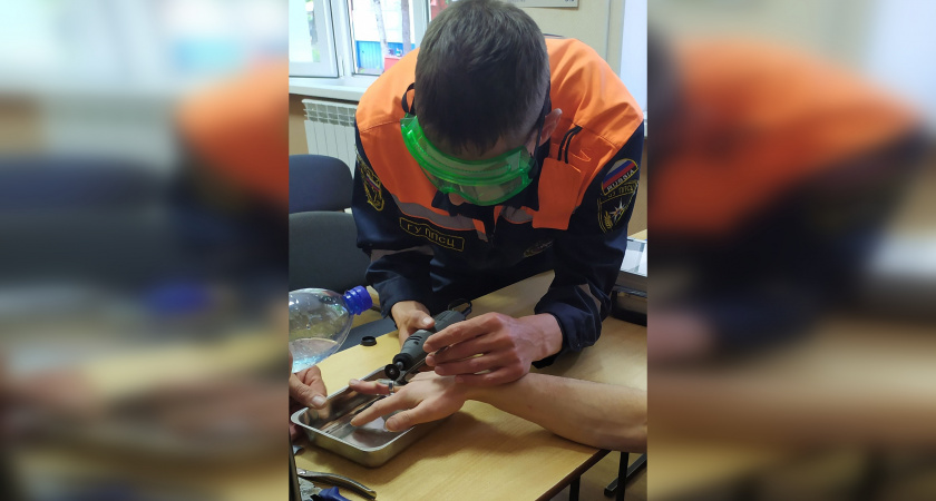 Пензенские спасатели освободили палец девушки от кольца