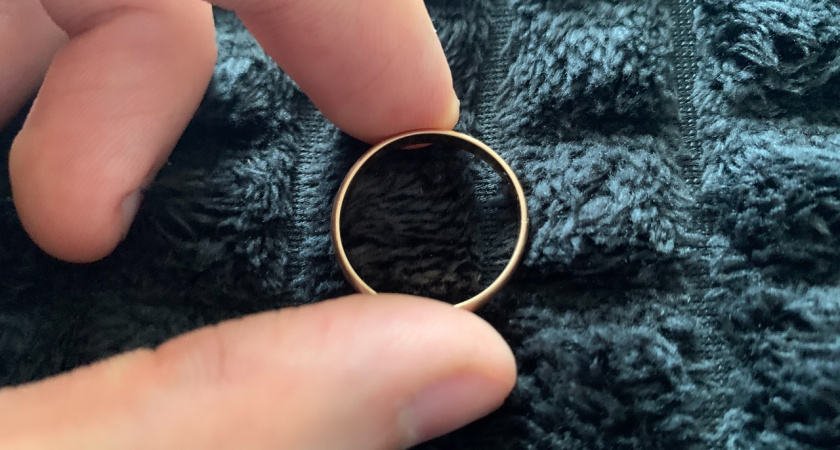 В Пензе спасатели помогли мужчине снять кольца