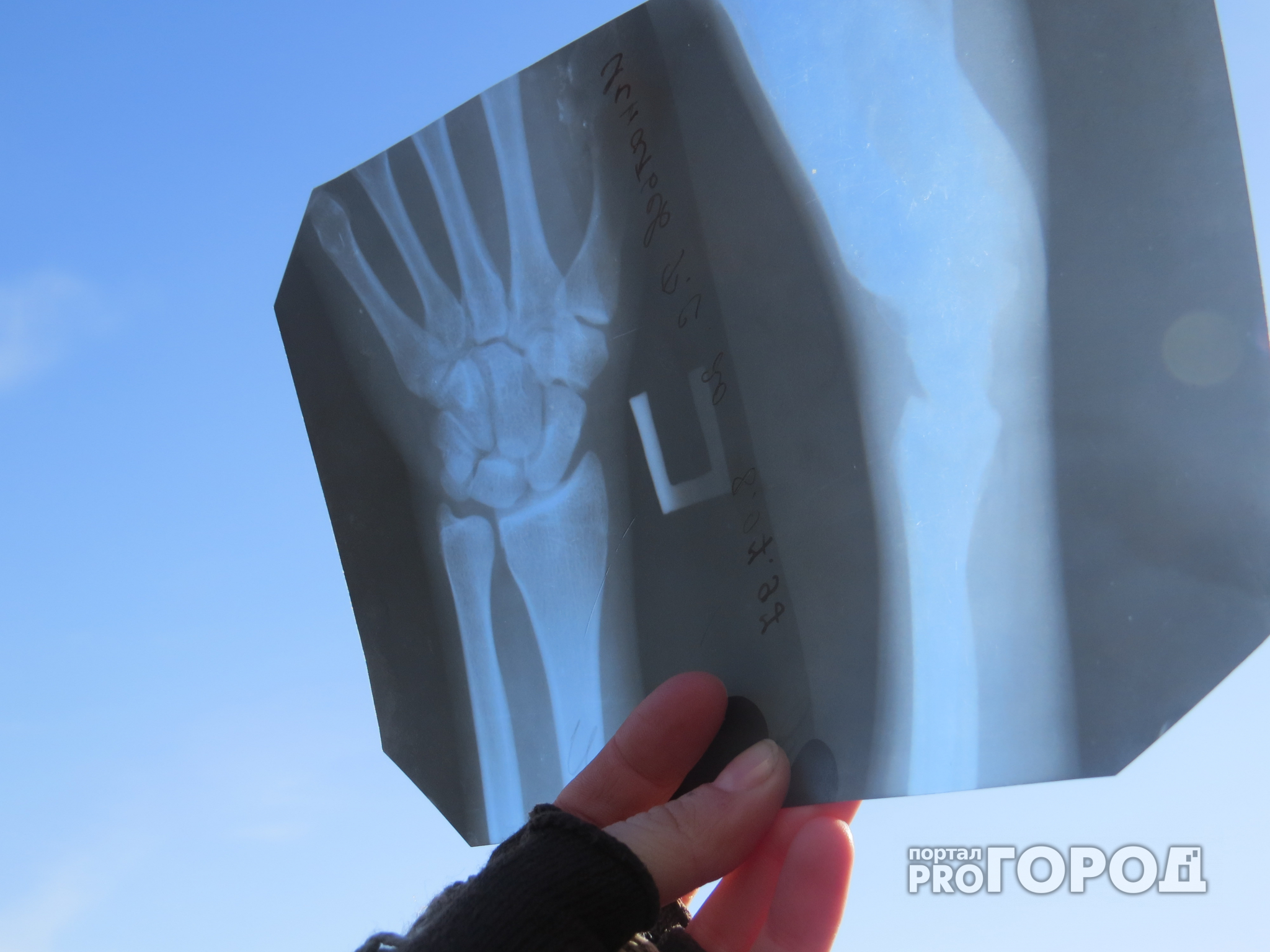 В больницы Пензы поступили рентгеновские аппараты с минимальной дозой облучения