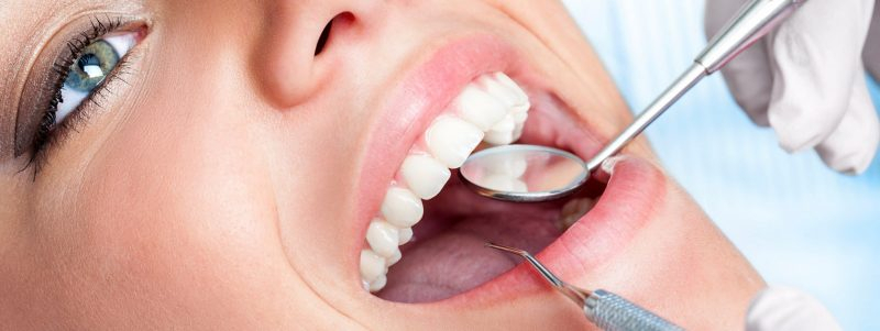 ТОП-3 причины провести процедуру протезирования зубов