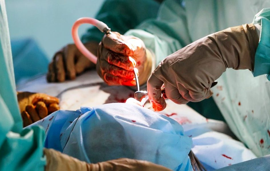 Хирургическая неточность: в Пензе продолжает работать врач, виновный в смерти пациента