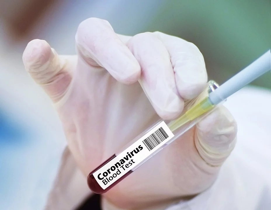 В Пензе подтвердились новые случаи заражения коронавирусом