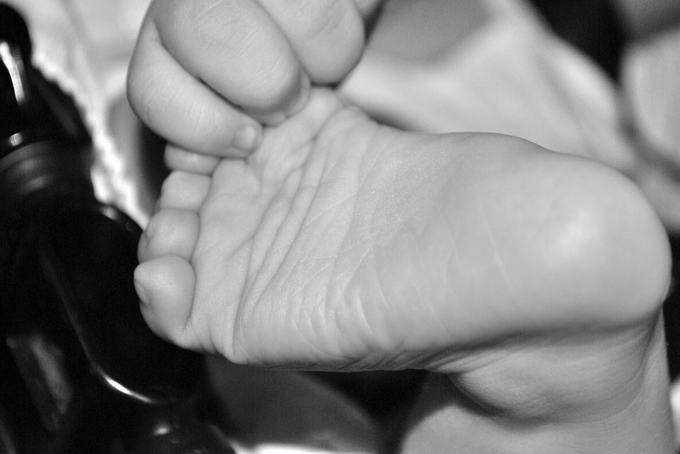 "Накипело, больно": пензячка рассказала о брошенной мамой малышке с ожогами от кислоты