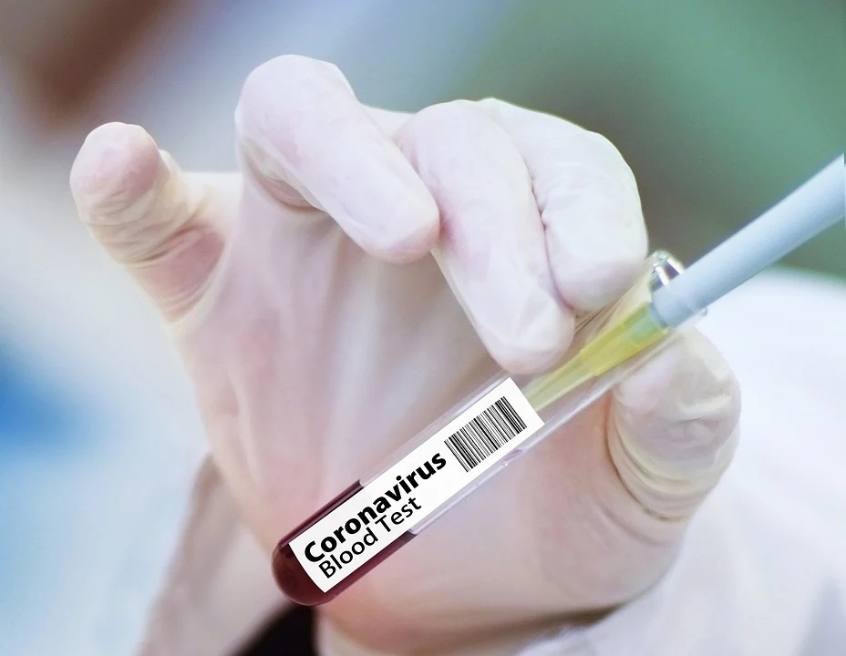 Эксперты оценили сможет ли коронавирус мутировать до "особо опасного"