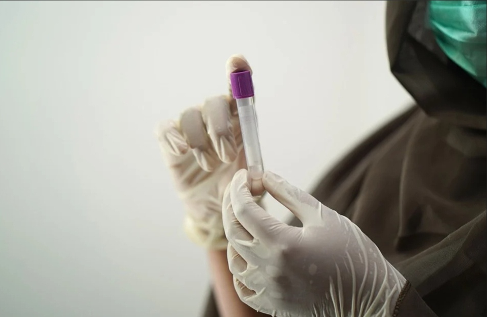 Во время второй волны люди начали умирать от коронавируса быстрее