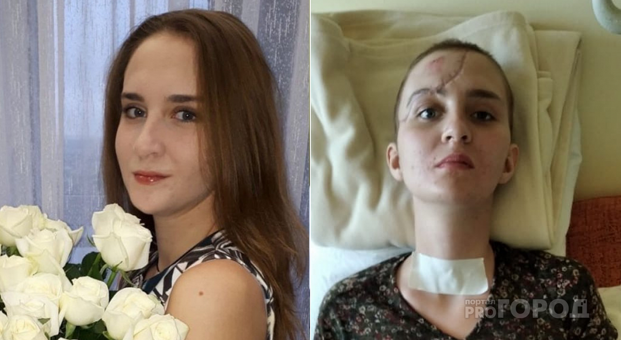 До и после: кошмарная авария навсегда изменила жизнь 21-летней пензячки
