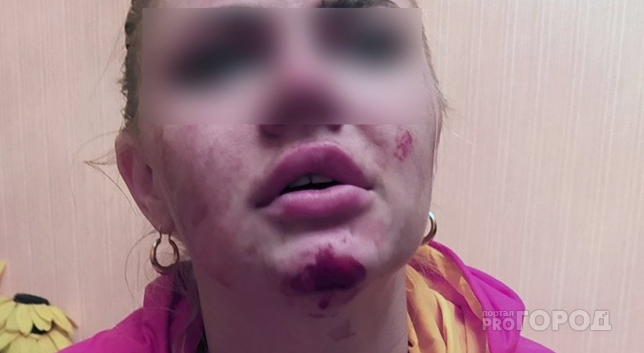 В Пензе девушку внезапно атаковал таксист