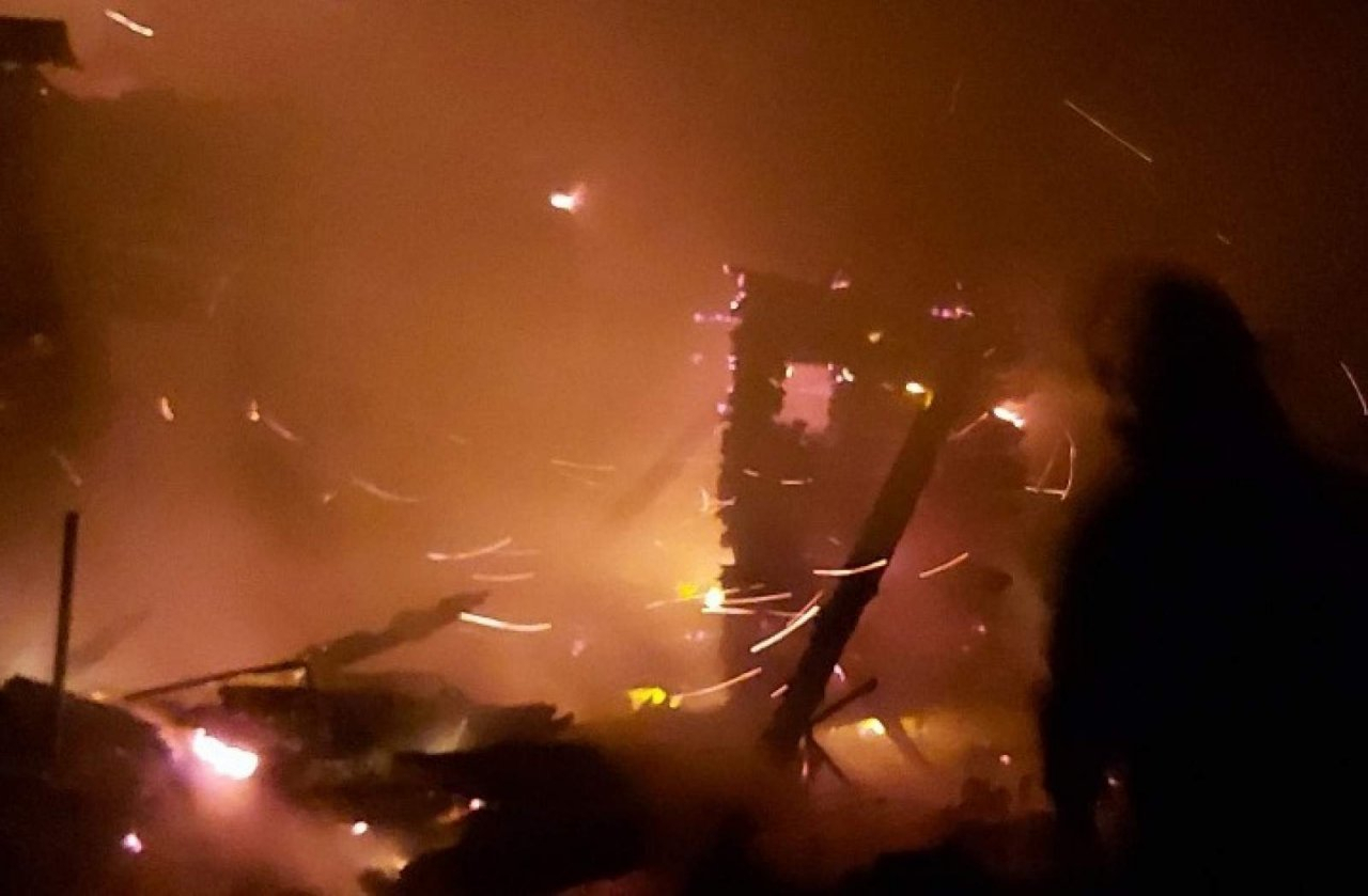 В Пензенской области при пожаре обгорел мужчина