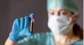 Ученые обнаружили особенные группы крови: какая у вас