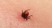 В Пензенской области клещи покусали более 330 детей