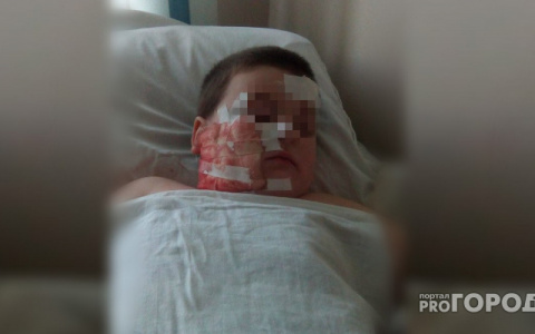 Хозяева собаки, изуродовавшей ребенка в Кузнецке, заплатят компенсацию