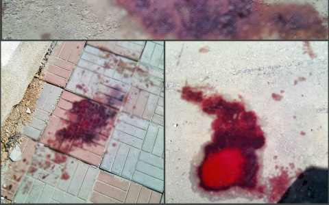 Кровь пензячки залила улицу Московскую