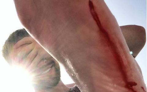 Пензенец Егор Крид поранил ногу, купаясь в Турции