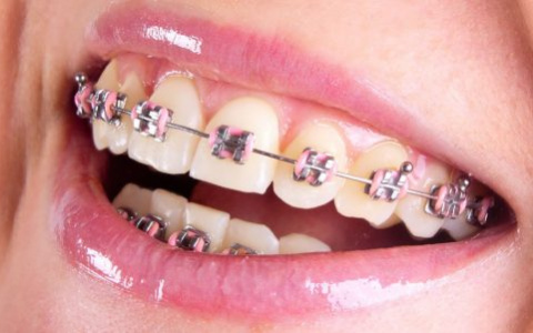 Стоматология «Династия»: цена красивой улыбки