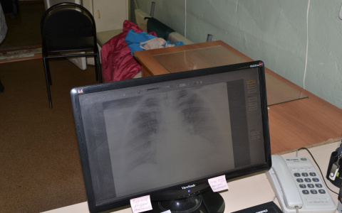 Пензенские врачи начали внедрять новый метод лечения туберкулёзников