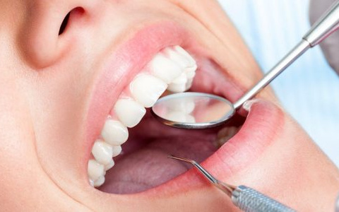 ТОП-3 причины провести процедуру протезирования зубов