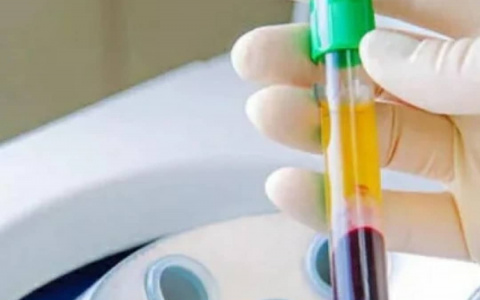 Плазмолифтинг: как сохранить здоровую и красивую улыбку до старости?