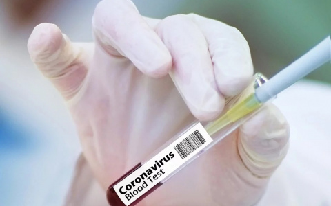 В Пензе подтвердились новые случаи заражения коронавирусом