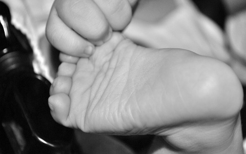 "Накипело, больно": пензячка рассказала о брошенной мамой малышке с ожогами от кислоты