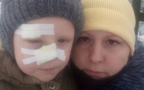 «Разрез до кости и глаз гноится»: мама мальчика рассказала о кошмаре наяву