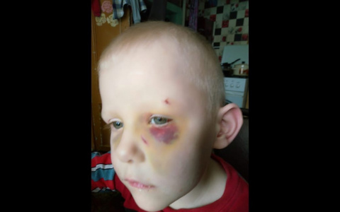 "Вину не признают": мать мальчика, упавшего на ножки бака в Сердобске, рассказала, как продвигается дело