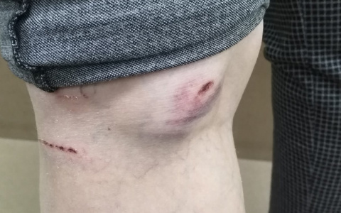 В парке Сердобска собака напала на женщину с детьми