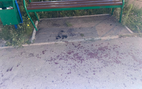 Под Пензой в драке мужчина зарезал незнакомца и сжег свои вещи