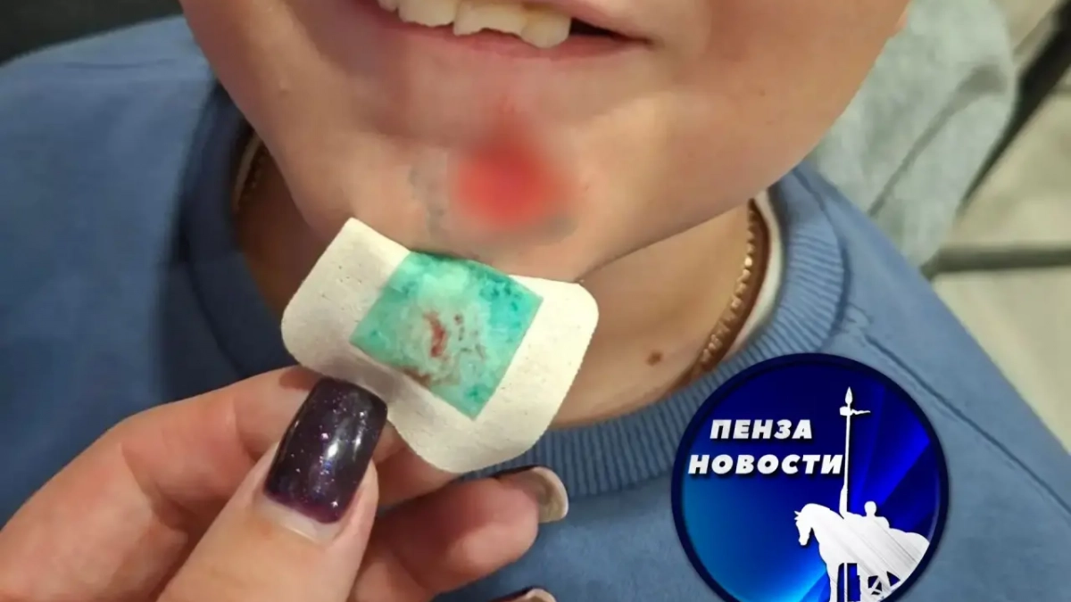 В Пензе прогулка по улице Львовской обернулась для ребенка выбитыми зубами и судом