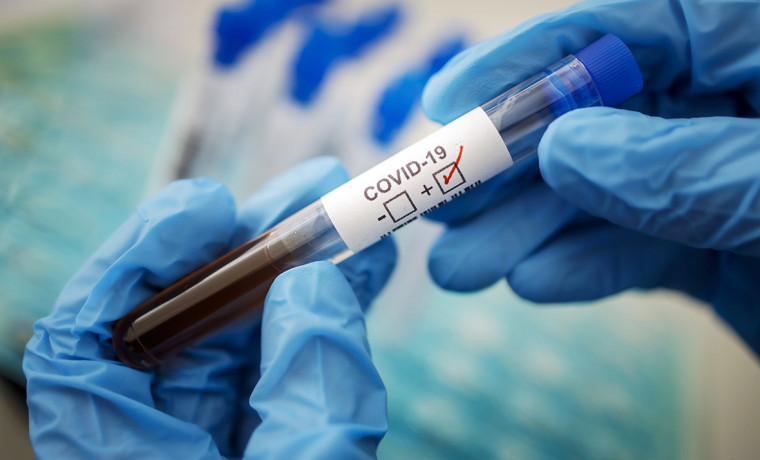 В Пензенской области от коронавируса умерли еще 5 человек