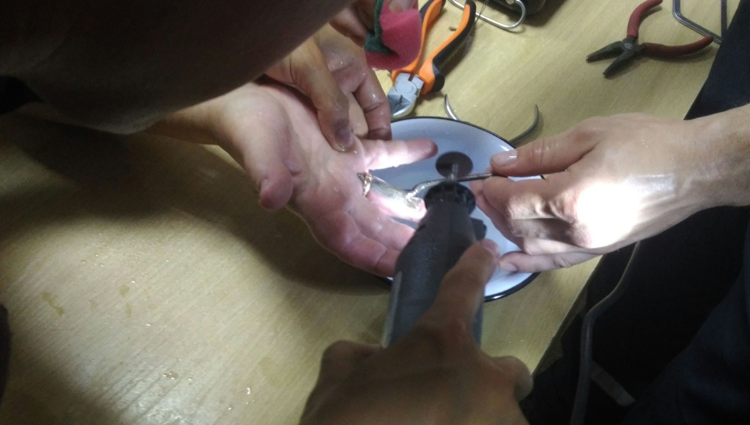 В Пензе спасатели помогли женщине снять кольцо